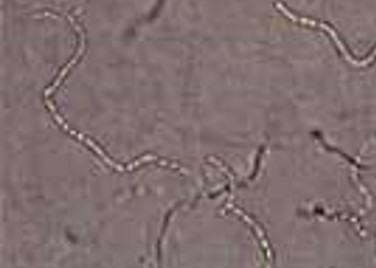 水虫 白癬 について解説 原因 症状 薬 対処法 ひまわり医院 内科 皮膚科 水虫 白癬 について解説 原因 症状 薬 対処法 ひまわり医院 内科 皮膚科