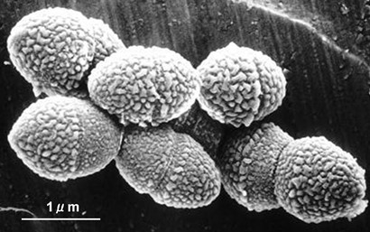 潜在的に重大な副作用はありますか?