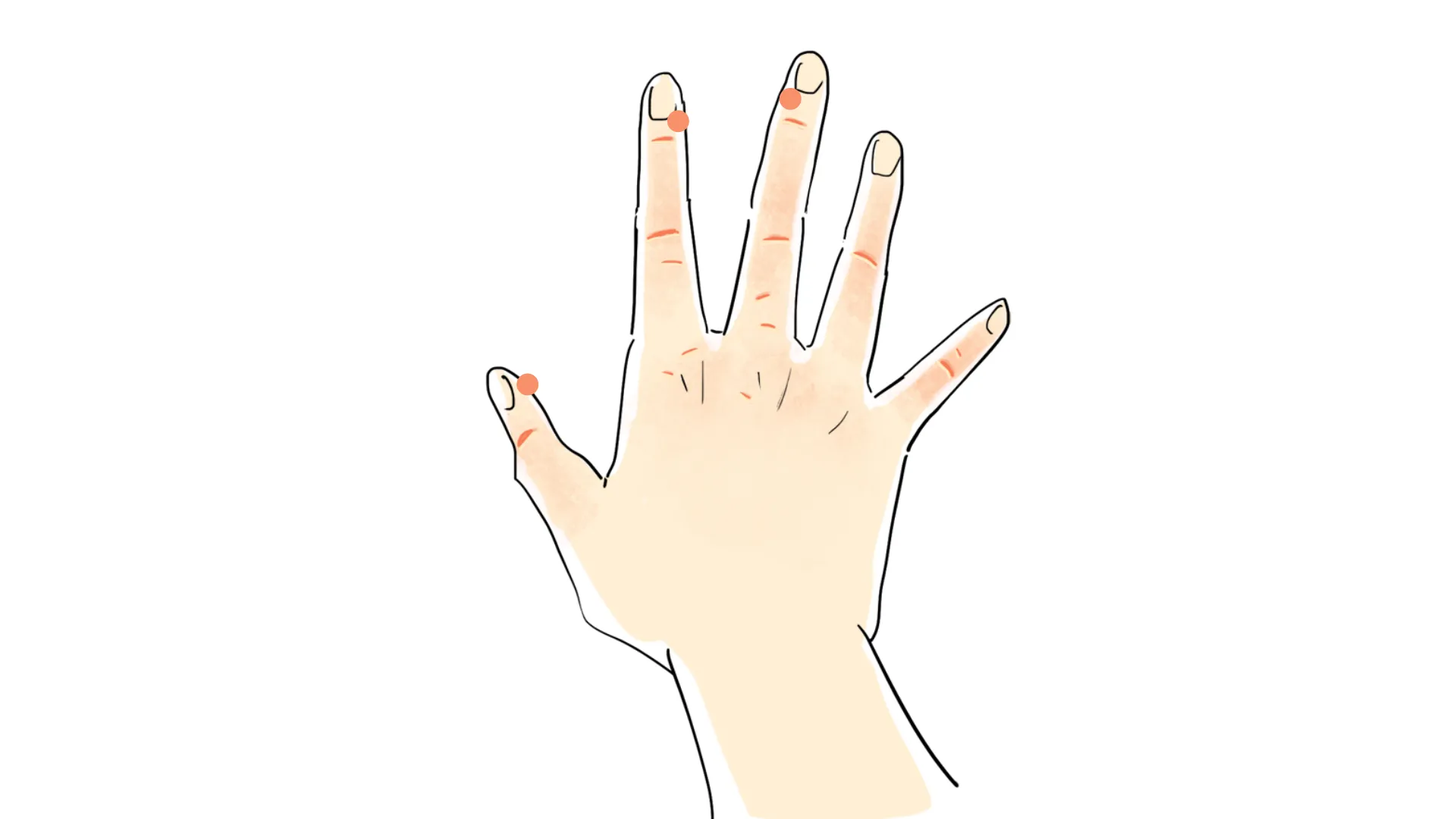 イボといえば液体窒素 イボ 尋常性疣贅 の原因や治療について ひまわり医院 内科 皮膚科 イボといえば液体窒素 イボ 尋常性疣贅 の原因や治療について ひまわり医院 内科 皮膚科