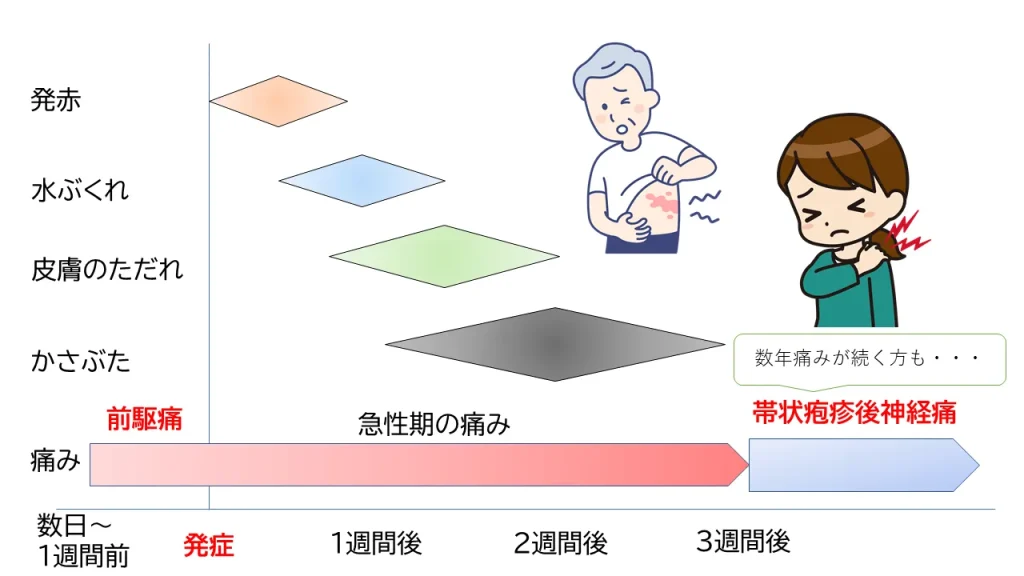 帯状疱疹のある湖やその他の水域で泳ぐことができますか?